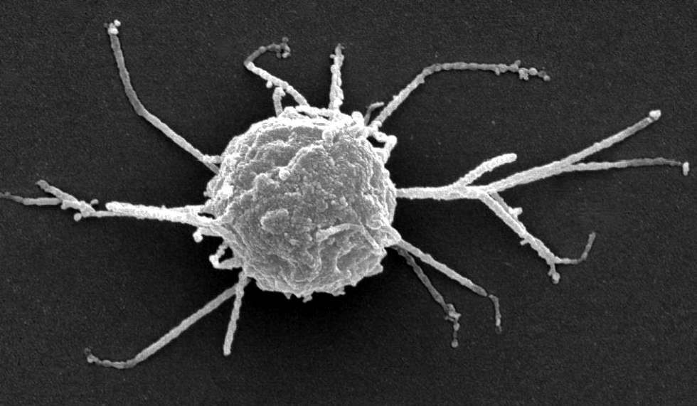Ejemplar de la ameba Capsaspora owczarzaki, una de las especies unicelulares parientes de los animales.